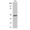 Keratin 18 antibody, LS-C381460, Lifespan Biosciences, Western Blot image 