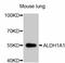 Aldehyde Dehydrogenase 1 Family Member A1 antibody, abx125290, Abbexa, Western Blot image 