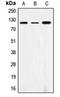 Signal Regulatory Protein Alpha antibody, orb215378, Biorbyt, Western Blot image 