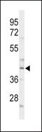 CCAAT Enhancer Binding Protein Alpha antibody, PA5-26487, Invitrogen Antibodies, Western Blot image 