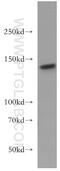 Inositol Polyphosphate-5-Phosphatase D antibody, 19694-1-AP, Proteintech Group, Western Blot image 