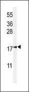 Inner Mitochondrial Membrane Peptidase Subunit 2 antibody, MBS9201258, MyBioSource, Western Blot image 