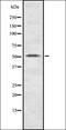 Patatin Like Phospholipase Domain Containing 2 antibody, orb337064, Biorbyt, Western Blot image 