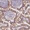 ArfGAP With Coiled-Coil, Ankyrin Repeat And PH Domains 3 antibody, NBP2-14257, Novus Biologicals, Immunohistochemistry paraffin image 