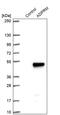 ADP-Ribose/CDP-Alcohol Diphosphatase, Manganese Dependent antibody, PA5-54893, Invitrogen Antibodies, Western Blot image 