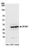 Sideroflexin-1 antibody, A305-443A, Bethyl Labs, Western Blot image 