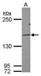 DAZ Interacting Zinc Finger Protein 3 antibody, PA5-32191, Invitrogen Antibodies, Western Blot image 