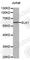 ETS Transcription Factor ELK1 antibody, A0789, ABclonal Technology, Western Blot image 