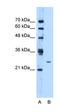 Transmembrane Protein 126B antibody, orb325472, Biorbyt, Western Blot image 