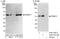 Proteasome 26S Subunit, Non-ATPase 11 antibody, A302-750A, Bethyl Labs, Western Blot image 