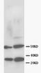RAD51 Recombinase antibody, PA1219, Boster Biological Technology, Western Blot image 