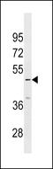 Inositol Hexakisphosphate Kinase 3 antibody, LS-C159928, Lifespan Biosciences, Western Blot image 