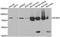 Acyl-CoA Synthetase Short Chain Family Member 2 antibody, LS-C334743, Lifespan Biosciences, Western Blot image 