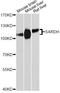 Sarcosine Dehydrogenase antibody, A9541, ABclonal Technology, Western Blot image 