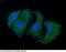 RELT TNF Receptor antibody, 10530-MM01, Sino Biological, Immunohistochemistry paraffin image 