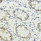 LIM Domain Binding 1 antibody, 16-992, ProSci, Immunohistochemistry paraffin image 