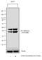 Tumor Protein P73 antibody, NB600-1279, Novus Biologicals, Western Blot image 
