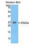 Farnesyl-Diphosphate Farnesyltransferase 1 antibody, LS-C297184, Lifespan Biosciences, Western Blot image 