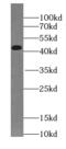 Sad1 And UNC84 Domain Containing 5 antibody, FNab08141, FineTest, Western Blot image 