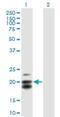 Carcinoembryonic Antigen Related Cell Adhesion Molecule 21 antibody, H00090273-B01P, Novus Biologicals, Western Blot image 