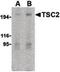 TSC Complex Subunit 2 antibody, LS-B613, Lifespan Biosciences, Western Blot image 