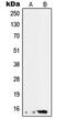 Splicing Factor 3b Subunit 6 antibody, MBS821067, MyBioSource, Western Blot image 