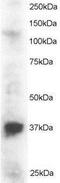 PIN2 (TERF1) Interacting Telomerase Inhibitor 1 antibody, NB100-890, Novus Biologicals, Western Blot image 
