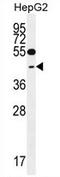 Glutaredoxin 3 antibody, AP54426PU-N, Origene, Western Blot image 