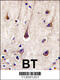 Phosphoinositide-3-Kinase Regulatory Subunit 2 antibody, 63-353, ProSci, Immunohistochemistry paraffin image 