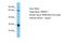 NEDD4 Binding Protein 2 Like 1 antibody, A18672, Boster Biological Technology, Western Blot image 