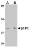 Sphingosine-1-Phosphate Receptor 1 antibody, LS-C83928, Lifespan Biosciences, Western Blot image 