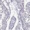 Inner Centromere Protein antibody, NBP2-62620, Novus Biologicals, Immunohistochemistry paraffin image 