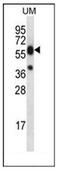 Lipase Family Member M antibody, AP52498PU-N, Origene, Western Blot image 