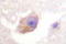 Tryptophan Hydroxylase 1 antibody, LS-C176562, Lifespan Biosciences, Immunohistochemistry paraffin image 