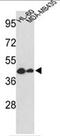 Gasdermin B antibody, AP18040PU-N, Origene, Western Blot image 