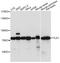 Tousled Like Kinase 1 antibody, A14831, ABclonal Technology, Western Blot image 