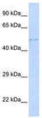 Tetrapeptide Repeat Homeobox 1 antibody, TA341545, Origene, Western Blot image 