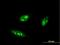 Interferon Regulatory Factor 4 antibody, H00003662-M05, Novus Biologicals, Immunocytochemistry image 