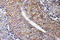 CTP Synthase 1 antibody, LS-C291691, Lifespan Biosciences, Immunohistochemistry frozen image 