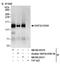 SWI/SNF Related, Matrix Associated, Actin Dependent Regulator Of Chromatin, Subfamily A, Member 5 antibody, NB100-55311, Novus Biologicals, Western Blot image 