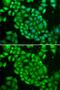 T Cell Leukemia/Lymphoma 1A antibody, GTX16378, GeneTex, Immunocytochemistry image 