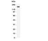 CF Transmembrane Conductance Regulator antibody, R31324, NSJ Bioreagents, Western Blot image 