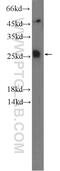 Transmembrane Protein 208 antibody, 23882-1-AP, Proteintech Group, Western Blot image 