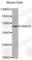 Growth Factor Receptor Bound Protein 10 antibody, A0634, ABclonal Technology, Western Blot image 