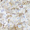 Cartilage Oligomeric Matrix Protein antibody, 16-556, ProSci, Immunohistochemistry frozen image 