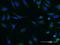 Serine/threonine-protein kinase SIK2 antibody, H00023235-M03, Novus Biologicals, Immunofluorescence image 