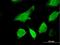 Gem Nuclear Organelle Associated Protein 6 antibody, H00079833-B01P, Novus Biologicals, Immunocytochemistry image 