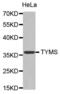 Thymidylate Synthetase antibody, abx000526, Abbexa, Western Blot image 