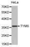 TNKS antibody, abx000526, Abbexa, Western Blot image 