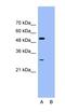 SRY-Box 5 antibody, orb329718, Biorbyt, Western Blot image 